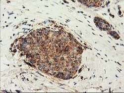 CLPP Monoclonal Antibody (OTI1F6), TrueMAB , OriGene 100 &mu;L; Unconjugated:Antibodies,