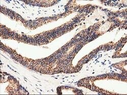 CLPP Monoclonal Antibody (OTI1F6), TrueMAB , OriGene 100 &mu;L; Unconjugated:Antibodies,