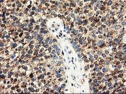 CLPP Monoclonal Antibody (OTI1F6), TrueMAB , OriGene 100 &mu;L; Unconjugated:Antibodies,
