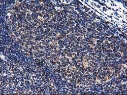 CLPP Monoclonal Antibody (OTI1F6), TrueMAB , OriGene 100 &mu;L; Unconjugated:Antibodies,