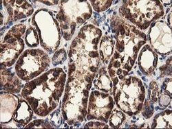 CLPP Monoclonal Antibody (OTI1F6), TrueMAB , OriGene 100 &mu;L; Unconjugated:Antibodies,