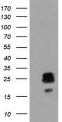 CLPP Mouse anti-Human, Clone: OTI1C7, lyophilized, TrueMAB 100 &mu;g; Unconjugated:Antibodies,