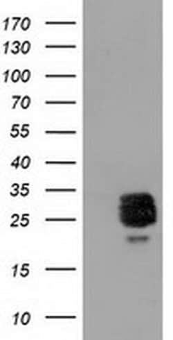 CLPP Monoclonal Antibody (OTI1G9), TrueMAB , OriGene 100 &mu;L; Unconjugated:Antibodies,