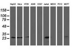 CLPP Mouse anti-Human, Clone: OTI1G9, lyophilized, TrueMAB 100 &mu;g; Unconjugated:Antibodies,