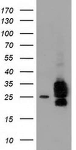CLPP Monoclonal Antibody (OTI1F6), TrueMAB , OriGene 100 &mu;L; Unconjugated:Antibodies,