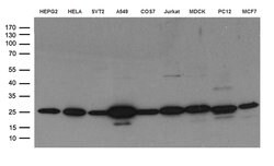 CLPP Monoclonal Antibody (OTI1D3), TrueMAB , OriGene 30 &mu;L; Unconjugated:Antibodies,