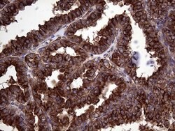 CLTA Monoclonal Antibody (OTI2D12), TrueMAB , OriGene:Antibodies:Primary