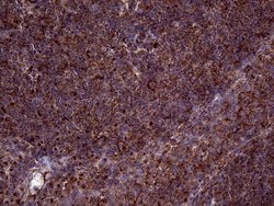 CLTA Monoclonal Antibody (OTI2D12), TrueMAB , OriGene 100 &mu;L; Unconjugated:Antibodies,