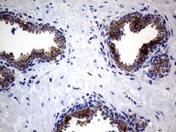 CLTA Monoclonal Antibody (OTI2F7), TrueMAB , OriGene 100 &mu;L; Unconjugated:Antibodies,