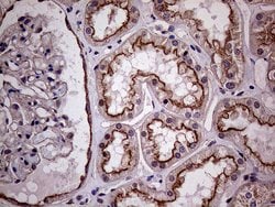 CLTA Monoclonal Antibody (OTI2C2), TrueMAB , OriGene 100 &mu;L; Unconjugated:Antibodies,