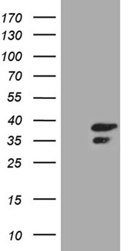 CLTA Monoclonal Antibody (OTI2F7), TrueMAB , OriGene 100 &mu;L; Unconjugated:Antibodies,