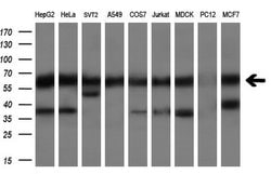 CLU Monoclonal Antibody (OTI2A7), TrueMAB , OriGene 100 &mu;L; Unconjugated:Antibodies,