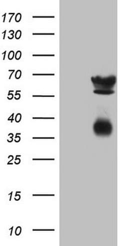 CLU Mouse anti-Human, Clone: OTI5D3, TrueMAB , Origene 30 &mu;L; Unconjugated:Antibodies,
