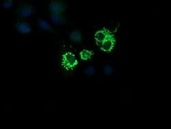 CMPK1 Monoclonal Antibody (OTI2B2), TrueMAB , OriGene 30 &mu;L; Unconjugated:Antibodies,
