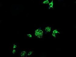 CMPK1 Monoclonal Antibody (OTI2F5), TrueMAB , OriGene:Antibodies:Primary
