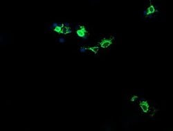 CMPK1 Monoclonal Antibody (OTI1D7), TrueMAB , OriGene:Antibodies:Primary