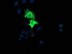 CMPK1 Mouse anti-Human, Clone: OTI1A9, lyophilized, TrueMAB 100 &mu;g;