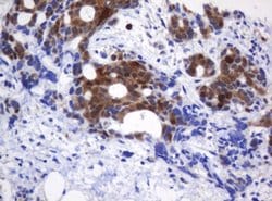 CMPK1 Monoclonal Antibody (OTI2A2), TrueMAB , OriGene 100 &mu;L; Unconjugated:Antibodies,