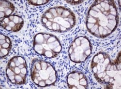 CMPK1 Monoclonal Antibody (OTI2A2), TrueMAB , OriGene 100 &mu;L; Unconjugated:Antibodies,