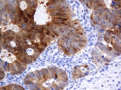 CMPK1 Monoclonal Antibody (OTI2A2), TrueMAB , OriGene 100 &mu;L; Unconjugated:Antibodies,