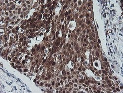 CMPK1 Monoclonal Antibody (OTI2B2), TrueMAB , OriGene 30 &mu;L; Unconjugated:Antibodies,