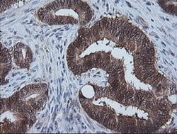 CMPK1 Monoclonal Antibody (OTI2B2), TrueMAB , OriGene 30 &mu;L; Unconjugated:Antibodies,