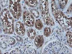 CMPK1 Monoclonal Antibody (OTI2B2), TrueMAB , OriGene 30 &mu;L; Unconjugated:Antibodies,