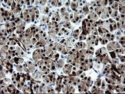 CMPK1 Mouse anti-Human, Clone: OTI1A1, lyophilized, TrueMAB 100 &mu;g;