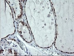 CMPK1 Mouse anti-Human, Clone: OTI1A1, lyophilized, TrueMAB 100 &mu;g;