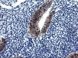 CMPK1 Mouse anti-Human, Clone: OTI1A1, lyophilized, TrueMAB 100 &mu;g;