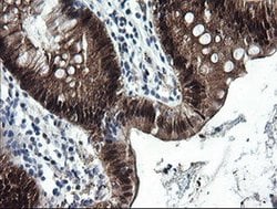 CMPK1 Mouse anti-Human, Clone: OTI1A1, lyophilized, TrueMAB 100 &mu;g;