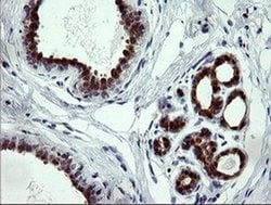 CMPK1 Monoclonal Antibody (OTI2F5), TrueMAB , OriGene:Antibodies:Primary