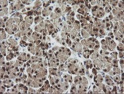 CMPK1 Monoclonal Antibody (OTI2F5), TrueMAB , OriGene 30 &mu;L; Unconjugated:Antibodies,