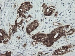 CMPK1 Monoclonal Antibody (OTI2F5), TrueMAB , OriGene 30 &mu;L; Unconjugated:Antibodies,