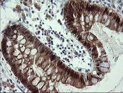 CMPK1 Monoclonal Antibody (OTI2F5), TrueMAB , OriGene 30 &mu;L; Unconjugated:Antibodies,