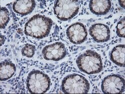 CMPK1 Mouse anti-Human, Clone: OTI1A9, lyophilized, TrueMAB 100 &mu;g;