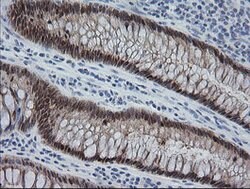 CMPK1 Mouse anti-Human, Clone: OTI1A9, lyophilized, TrueMAB 100 &mu;g;