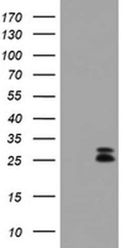 CMPK1 Monoclonal Antibody (OTI2A2), TrueMAB , OriGene 100 &mu;L; Unconjugated:Antibodies,