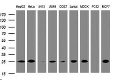 CMPK1 Monoclonal Antibody (OTI2A2), TrueMAB , OriGene 100 &mu;L; Unconjugated:Antibodies,