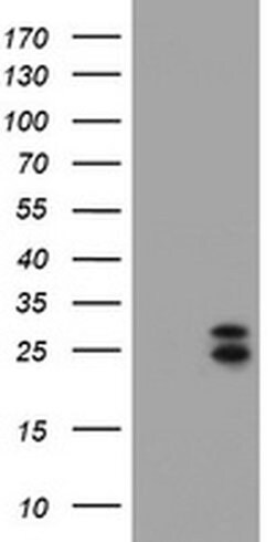 CMPK1 Monoclonal Antibody (OTI1H3), TrueMAB , OriGene:Antibodies:Primary