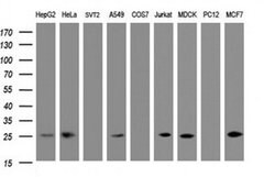 CMPK1 Monoclonal Antibody (OTI1H3), TrueMAB , OriGene 30 &mu;L; Unconjugated:Antibodies,