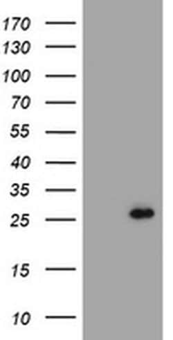 CMPK1 Monoclonal Antibody (OTI1H1), TrueMAB , OriGene:Antibodies:Primary