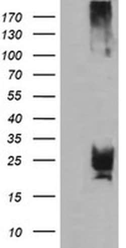 CMPK1 Monoclonal Antibody (OTI2B2), TrueMAB , OriGene 30 &mu;L; Unconjugated:Antibodies,
