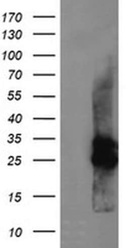 CMPK1 Monoclonal Antibody (OTI1A1), TrueMAB , OriGene 100 &mu;L; Unconjugated:Antibodies,
