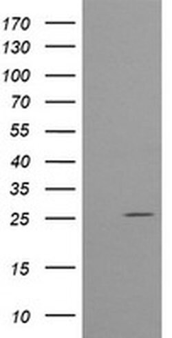 CMPK1 Monoclonal Antibody (OTI2F5), TrueMAB , OriGene 30 &mu;L; Unconjugated:Antibodies,