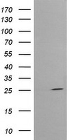 CMPK1 Monoclonal Antibody (OTI1D7), TrueMAB , OriGene 30 &mu;L; Unconjugated:Antibodies,