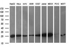 CMPK1 Monoclonal Antibody (OTI1D7), TrueMAB , OriGene 30 &mu;L; Unconjugated:Antibodies,