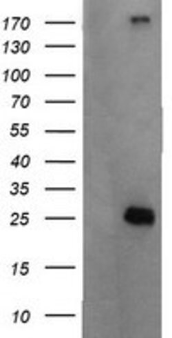 CMPK1 Mouse anti-Human, Clone: OTI1A9, lyophilized, TrueMAB 100 &mu;g;