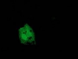 CNDP1 Monoclonal Antibody (OTI1A5), TrueMAB , OriGene:Antibodies:Primary