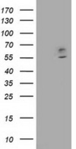 CNDP1 Mouse anti-Human, Clone: OTI2D2, lyophilized, TrueMAB 100 &mu;g;